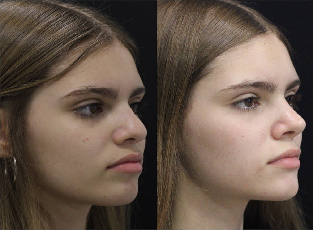 AMANDA ANTES E DEPOIS