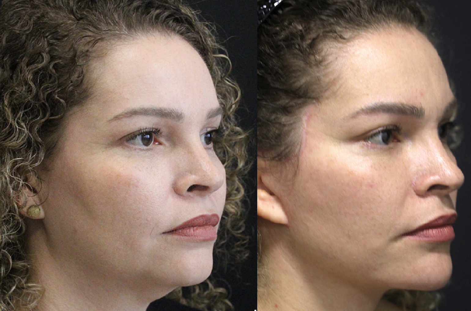 IMG_5795 antes e depois